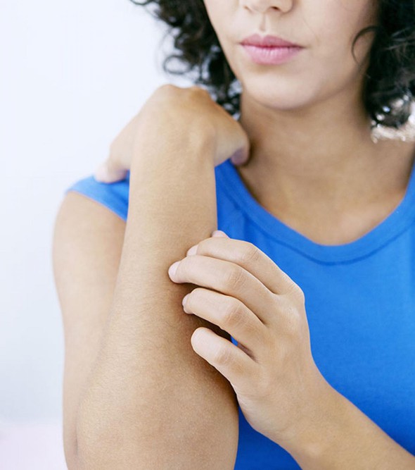 Eczema: How to stop Itching