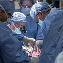 Първата трансплантация на матка - неуспешна