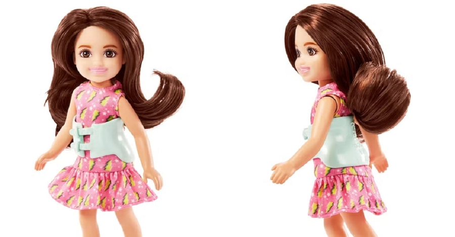 Η Mattel παρουσιάζει την πρώτη Barbie με σκολίωση!