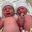 Ρεκόρ: Δίδυμα γεννήθηκαν από έμβρυο που είχε καταψυχθεί πριν από 30 χρόνια  