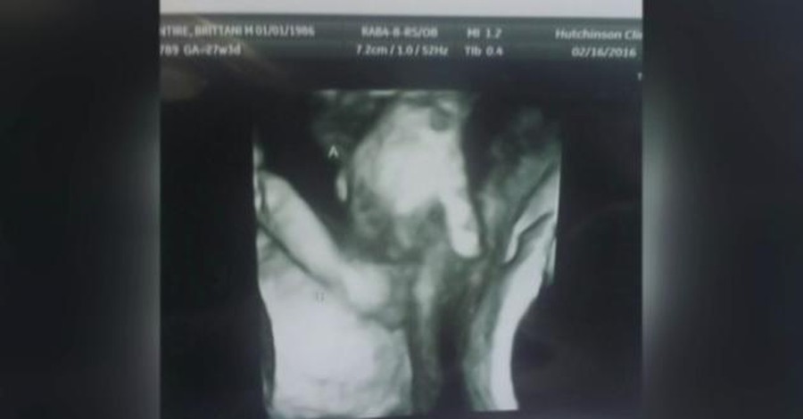 Близнаци държат ръцете си в утробата