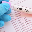Какво трябва да знае бременната жена за цитомегаловируса (CMV)