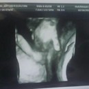 Близнаци държат ръцете си в утробата