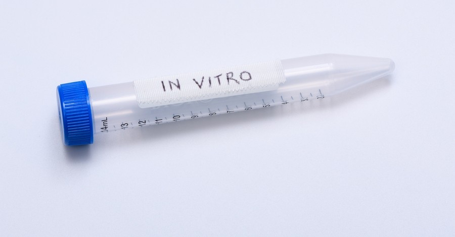 Fertilizarea in vitro – întrebări frecvente
