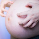Как да се справим със сърбежа по корема по време на бременност?