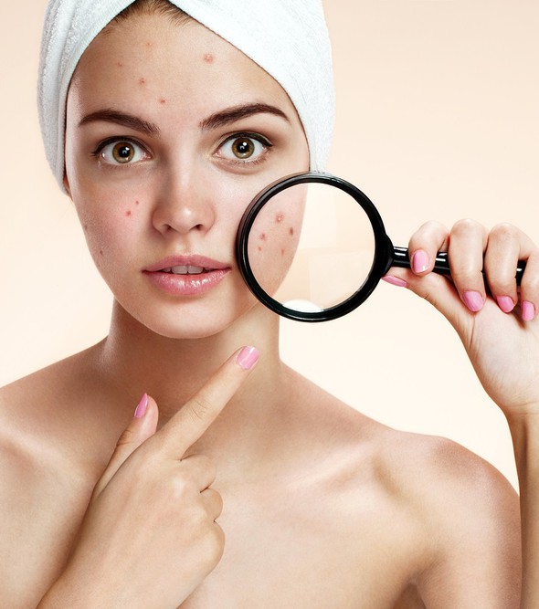 15 Products against Acne