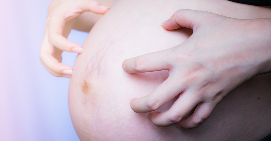 Как да се справим със сърбежа по корема по време на бременност?