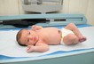 Umbilical cord baby hospital