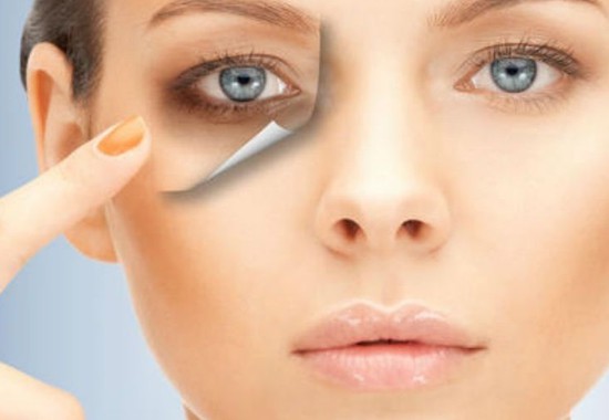 10 solutions for swollen eyelids