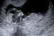 Baby womb