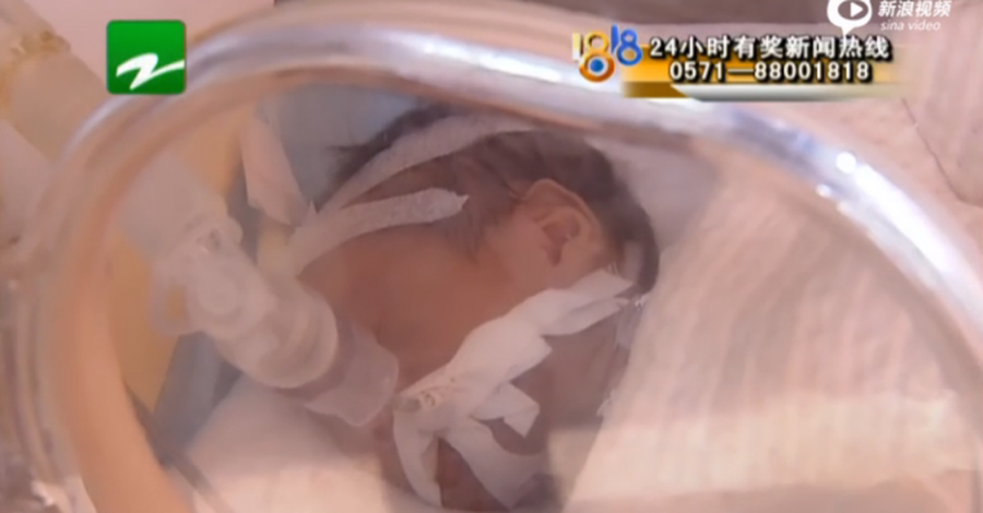 Бебе се събуди секунди, преди да бъде кремирано 