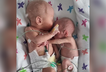 Premature twins defy odds hug