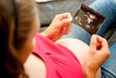 Pregnancy pregnant ultrasound