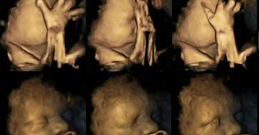 Ecografia 4D arată efectele dăunătoare ale fumatului în timpul sarcinii