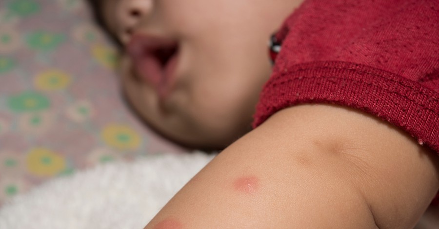 Ухапвания от комари при бебетата