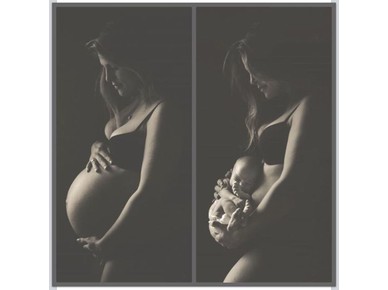 Φωτογραφίζοντας το πριν και το μετά της εγκυμοσύνης