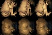 Scan fetus