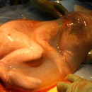 Miracolul nașterii: Bebeluși născuți în sacul amniotic 